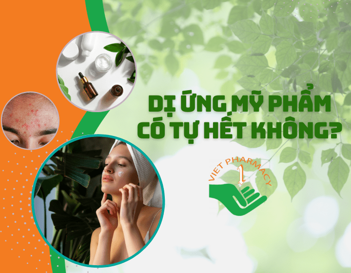 Giải đáp: Dị ứng mỹ phẩm có tự hết không?